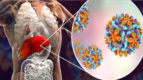 مركز دكتور هشام الوكيل لمناظير الجهاز الهضمى وأمراض الكبد مناظير البنكرياس ومنظار الموجات الصوتية
