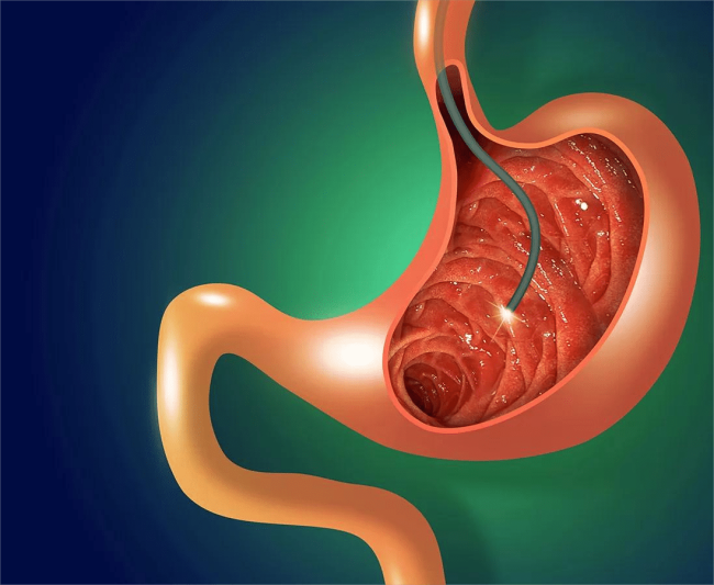 مركز دكتور هشام الوكيل لمناظير الجهاز الهضمى وأمراض الكبد مناظير البنكرياس ومنظار الموجات الصوتية